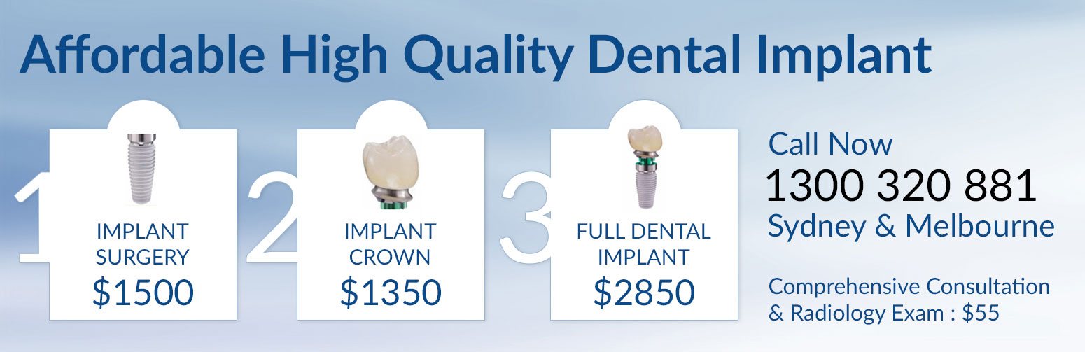 Average Cost Of Tooth Implant Australia change comin