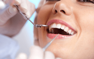 cheap-dental-implant-melbourne