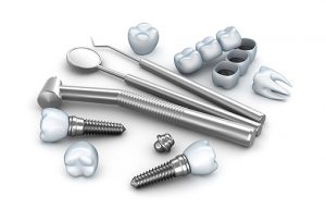 Dental Implants – A Flexible Restoration Option