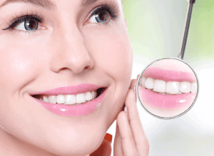 Dental implants