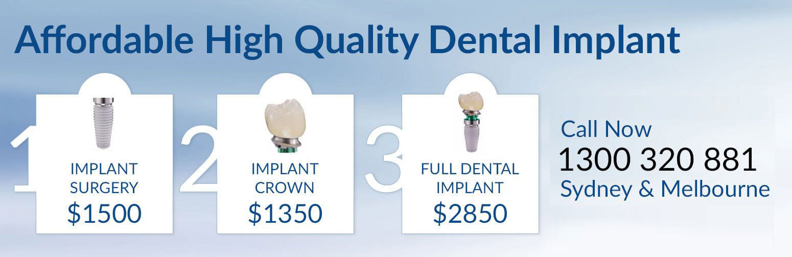 Affordable High Quality Dental Implant