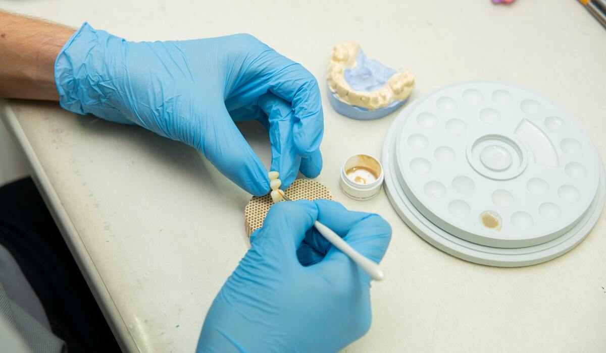 Dental Problems Caused By Missing Teeth How to Prevent It?